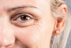 Close-up of mature woman’s eye area showing fine lines and wrinkles.