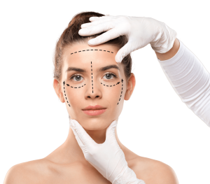 Woman with facial treatment guide markings for aesthetic procedures.